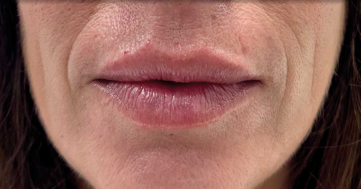 Labios Labios 2