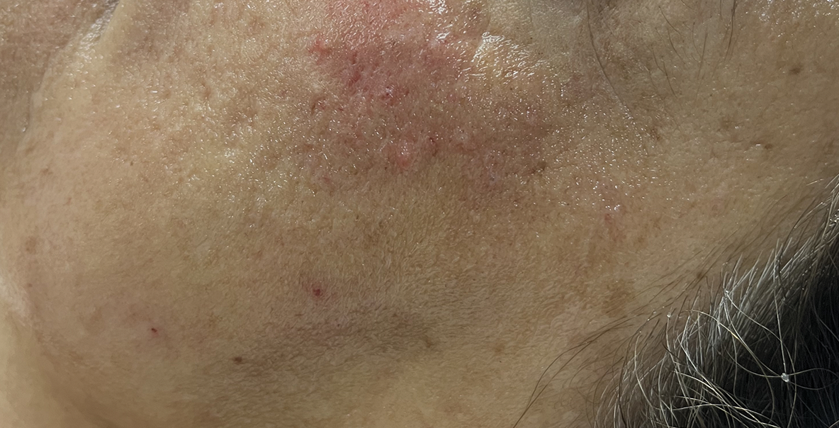 Hydrafacial Captura De Pantalla 2026 01 26 A Las 12.54.21