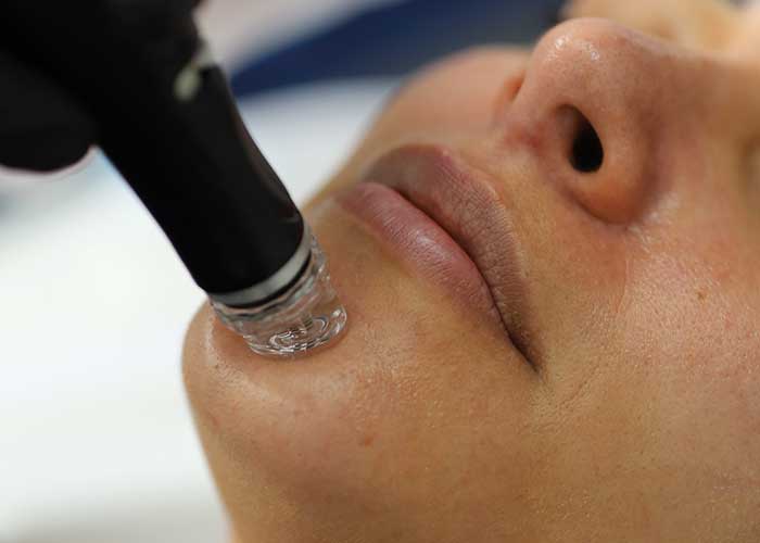 Tratamiento facial
